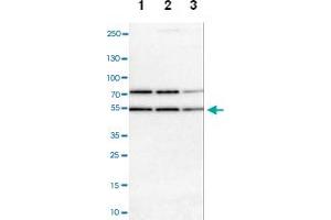 Western blot analysis of Lane 1: NIH-3T3 cell lysate (Mouse embryonic fibroblast cells), Lane 2: NBT-II cell lysate (Rat Wistar bladder tumour cells), Lane 3: PC12 cell lysate (Pheochromocytoma of rat adrenal medulla) with RBM22 polyclonal antibody at 1:100-1:500 dilution. (RBM22 anticorps)