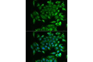 Immunofluorescence analysis of MCF-7 cells using RBP2 antibody (ABIN5974059). (RBP2 anticorps)