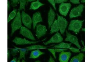 Immunofluorescence analysis of L929 cells using SARDH Polyclonal Antibody at dilution of 1:100 (40x lens).