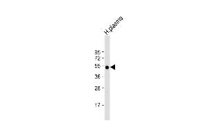 Anti-IGHG1 Antibody (Center) at 1:2000 dilution + human plasma lysate Lysates/proteins at 20 μg per lane. (IGHG1 anticorps  (AA 154-180))
