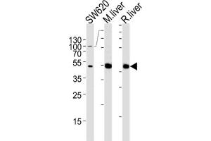 Western Blotting (WB) image for anti-Ornithine Carbamoyltransferase (OTC) antibody (ABIN3002885) (OTC anticorps)
