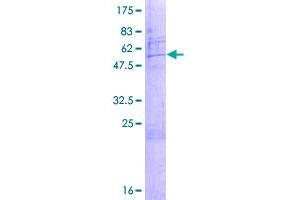 Image no. 1 for Small Nuclear Ribonucleoprotein Polypeptide A (SNRPA) (AA 1-255) protein (GST tag) (ABIN1320825)
