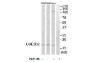 Western blot analysis of extracts from HeLa cells, A549 cells and K562 cells, using UBE2D2 antibody. (UBE2D2 anticorps  (C-Term))