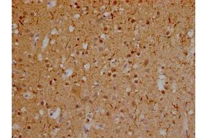 IHC image of ABIN7127835 diluted at 1:100 and staining in paraffin-embedded human brain tissue performed on a Leica BondTM system. (Recombinant MAPT anticorps)