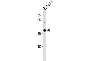 Western Blotting (WB) image for anti-Selenoprotein M (SELM) antibody (ABIN3004720) (SELM anticorps)