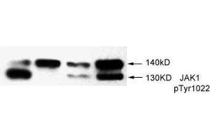Image no. 1 for anti-Janus Kinase 1 (JAK1) (pTyr1022) antibody (ABIN273479) (JAK1 anticorps  (pTyr1022))
