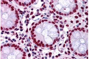 Human Colon: Formalin-Fixed, Paraffin-Embedded (FFPE) (KAP1 anticorps  (AA 823-835))