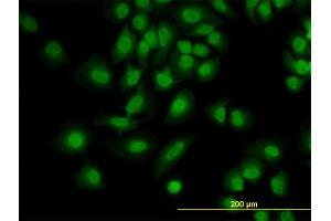 Immunofluorescence of monoclonal antibody to PDCD6 on HeLa cell. (PDCD6 anticorps  (AA 92-191))