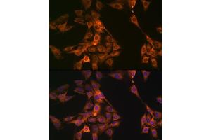 Immunofluorescence analysis of C6 cells using NL1 Rabbit mAb (ABIN7269060) at dilution of 1:100 (40x lens).