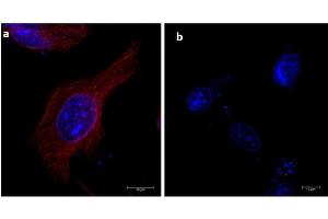 Immunofluorescence of α-tubulin using 680-conjugated Fluorescent anti-mouse IgG Immunofluorescence microscopy of α-tubulin in HeLa cells using 680-conjugated Fluorescent anti-mouse IgG  for detection.