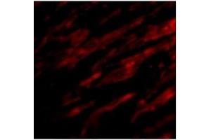 Immunofluorescence of PDL-1 in Human Heart cells with PDL-1at 20 ug/ml. (PD-L1 anticorps  (Center))