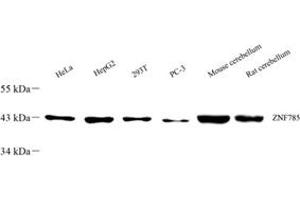 Western blot analysis of ZNF785 (ABIN7076274) at dilution of 1: 500 (ZNF785 anticorps)