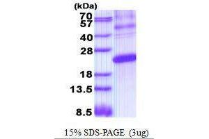 Figure annotation denotes ug of protein loaded and % gel used. (ESM1 Protéine)