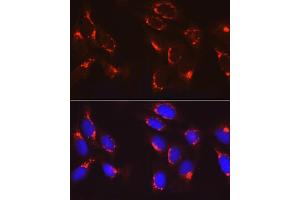 Immunofluorescence analysis of U2OS cells using COPB2 Rabbit pAb (ABIN6129253, ABIN6138871, ABIN6138872 and ABIN6222818) at dilution of 1:100 (40x lens).