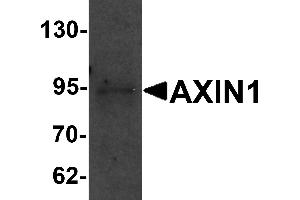Western Blotting (WB) image for anti-Axin 1 (AXIN1) (C-Term) antibody (ABIN1030273) (Axin anticorps  (C-Term))
