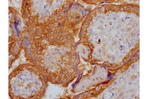 IHC image of ABIN7127467 diluted at 1:100 and staining in paraffin-embedded human placenta tissue performed on a Leica BondTM system.