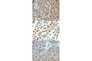 Immunohistochemical staining (Formalin-fixed paraffin-embedded sections) of human pancreas (A), rat pancreas (B) and mouse pancreas (C) with ELA3B monoclonal antibody, clone CELA3B/1257 .
