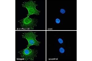 (ABIN185358) Immunofluorescence analysis of paraformaldehyde fixed HeLa cells, permeabilized with 0. (PLXND1 anticorps  (Internal Region))