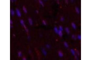 Immunofluorescence analysis of Mouse heart tissue using CD5 Monoclonal Antibody at dilution of 1:200. (CD5 anticorps)