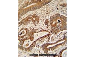 Immunohistochemistry (IHC) image for anti-Ethylmalonic Encephalopathy 1 (ETHE1) antibody (ABIN3002726)