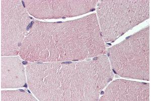 Anti-TXLNB antibody  ABIN960834 IHC staining of human skeletal muscle. (Taxilin beta anticorps  (Internal Region))