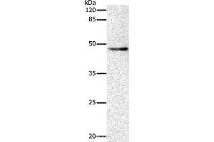 Western blot analysis of Hela cell, using DRD1 Polyclonal Antibody at dilution of 1:500