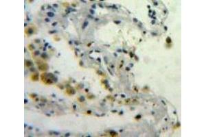 Used in DAB staining on fromalin fixed paraffin-embedded Lung tissue