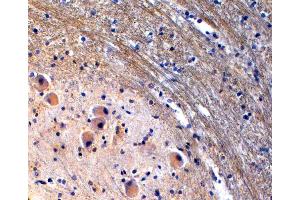 (ABIN185533) (2 μg/mL) staining of paraffin embedded Human Brain Stem. (Tryptophan Hydroxylase 2 anticorps  (Internal Region))