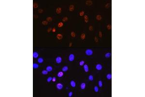 Immunofluorescence analysis of NIH-3T3 cells using Cyclin H Rabbit mAb (ABIN7266569) at dilution of 1:100 (40x lens).