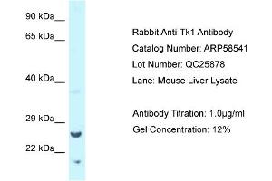 Western Blotting (WB) image for anti-Thymidine Kinase 1, Soluble (TK1) (Middle Region) antibody (ABIN2787731) (TK1 anticorps  (Middle Region))