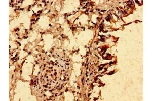 Immunohistochemistry of paraffin-embedded human lung tissue using ABIN7151248 at dilution of 1:100 (TRIM21 anticorps  (AA 1-475))