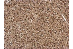 IHC-P Image Immunohistochemical analysis of paraffin-embedded RT2 xenograft, using FGF13, antibody at 1:500 dilution.