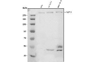 Western blot analysis of Neurofibromin/NF1 using anti-Neurofibromin/NF1 antibody (ABIN7600196).