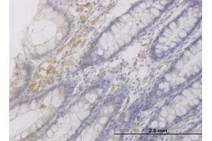 anti-RAB42, Member RAS Oncogene Family (RAB42) (AA 46-106) antibody