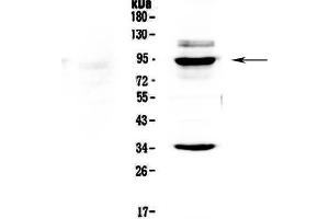 Western blot analysis of BRD7 using anti-BRD7 antibody . (BRD7 anticorps  (AA 514-567))