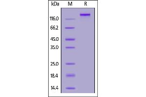Biotinylated SARS-CoV-2 Spike Trimer, His,Avitag (B.