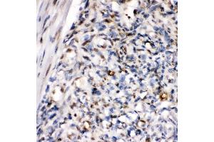 IHC analysis of ZEB1 using anti-ZEB1 antibody (ABIN7602984). (ZEB1 anticorps  (Middle Region))