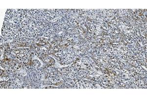 IHC analysis of DGKZ/DGK-zeta using anti-DGKZ/DGK-zeta antibody (ABIN7602261). (DGKZ anticorps  (AA 664-928))