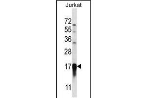 Western blot analysis in Jurkat cell line lysates (35ug/lane). (PFDN5 anticorps  (AA 79-108))