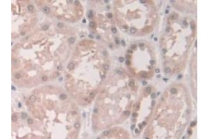 Detection of GCA in Human Kidney Tissue using Polyclonal Antibody to Grancalcin (GCA)