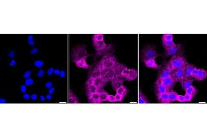Immunocytochemical staining of HT- cells with Opioid receptor delta 1 antibody (ABIN7799704), 1:1,000). (Recombinant OPRD1 anticorps)