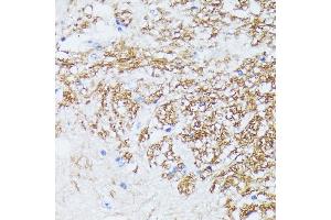 Immunohistochemistry of paraffin-embedded mouse spinal cord using CTNN antibody (ABIN7266134) at dilution of 1:100 (40x lens). (CTNNA2 anticorps  (AA 150-300))