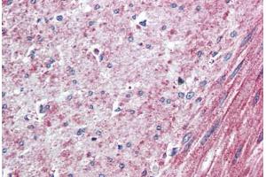 Human Colon, Smooth Muscle (formalin-fixed, paraffin-embedded) stained with ELTD1 antibody ABIN410769 followed by biotinylated goat anti-rabbit IgG secondary antibody ABIN481713, alkaline phosphatase-streptavidin and chromogen. (ELTD1 anticorps  (N-Term))