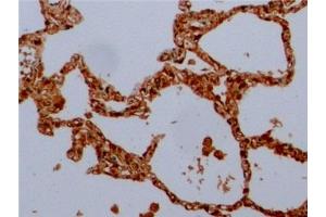Detection of TUBb in Human Lung Tissue using Anti-Tubulin Beta (TUBb) Monoclonal Antibody