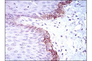Immunohistochemical analysis of paraffin-embedded esophagus tissues using BRCA1 mouse mAb with DAB staining.