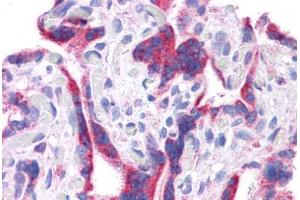 Human Placenta: Formalin-Fixed, Paraffin-Embedded (FFPE)