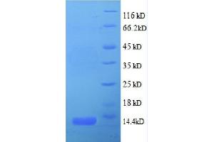Chemokine (C-X-C Motif) Ligand 5 (CXCL5) (AA 37-110), (partial) protein (His tag)