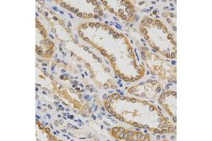 Immunohistochemistry of paraffin-embedded human kidney using IFNB1 antibody at dilution of 1:200 (x400 lens) (IFNB1 anticorps)