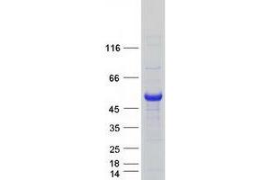 Validation with Western Blot