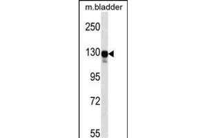 Mouse Map3k6 Antibody (N-term) (ABIN657839 and ABIN2846801) western blot analysis in mouse bladder tissue lysates (35 μg/lane). (MAP3K6 anticorps  (N-Term))